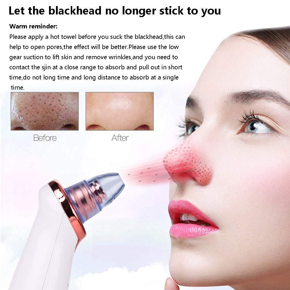 Electric Blackhead Remover Pore Vacuum Cleaner